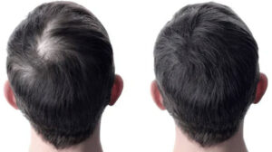 Best for Hair Growth