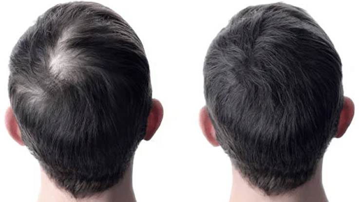 Best for Hair Growth