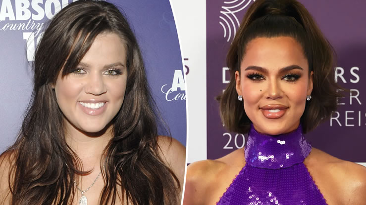 Kardashian's Cosmetic Procedures