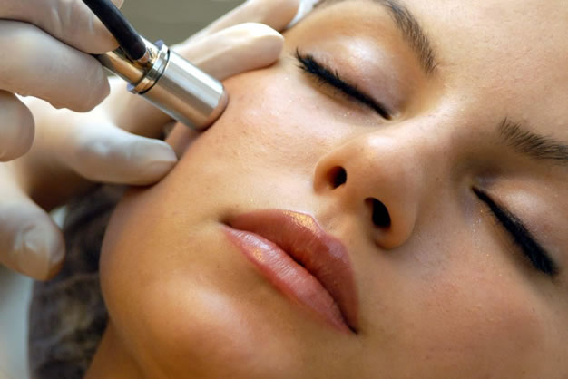 What does microdermabrasion do to your face?