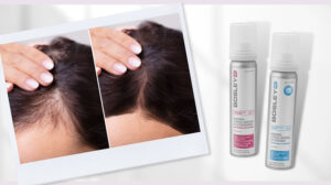 topical minoxidil