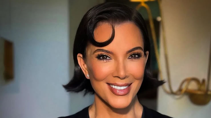 Kris Jenner facelift