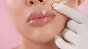 Lip Fillers UK