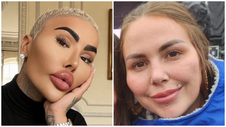 Cosmetic Surgery Deaths
